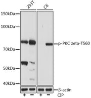 Phospho-PKC zeta-T560 Rabbit mAb