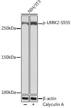 Phospho-LRRK2-S935 Rabbit mAb