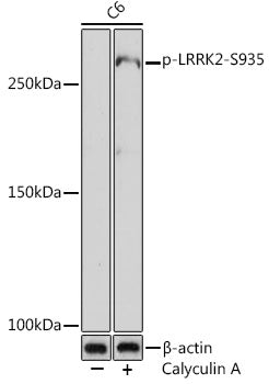 Phospho-LRRK2-S935 Rabbit mAb