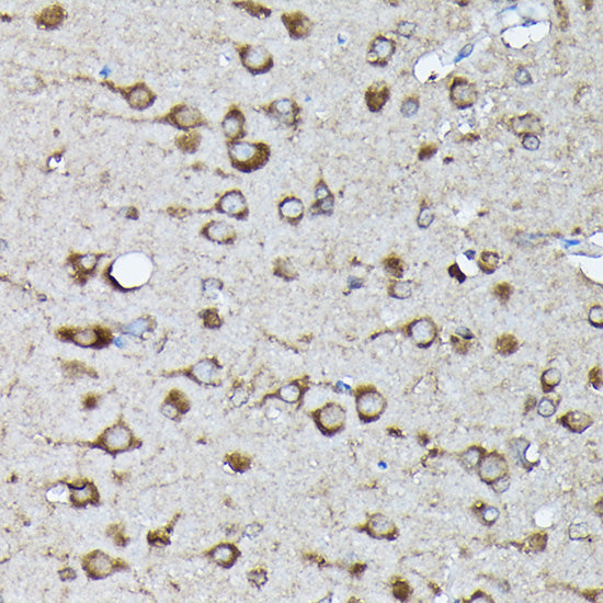 Phospho-KRAS-S89 Rabbit pAb