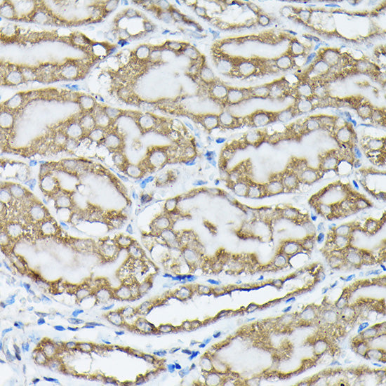 Phospho-KRAS-S89 Rabbit pAb