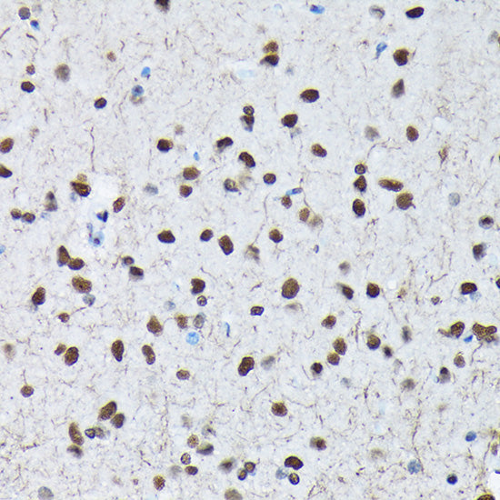 Phospho-c-Jun-S63 Rabbit pAb