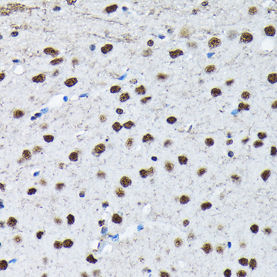 Phospho-c-Jun-S63 Rabbit pAb