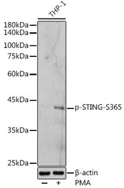Phospho-STING/TMEM173-S365 Rabbit pAb