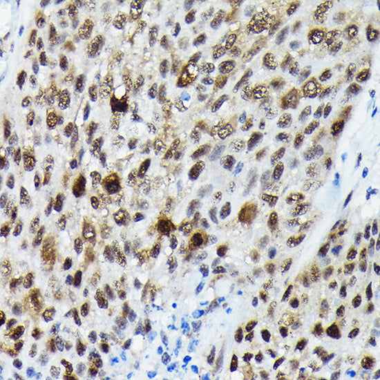 Phospho-FOXO3A-S425 Rabbit pAb