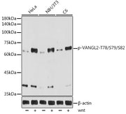 Phospho-VANGL2-T78/S79/S82 Rabbit mAb