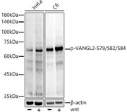 Phospho-VANGL2-S79/S82/S84 Rabbit mAb