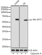 Phospho-Akt-S473 Rabbit mAb