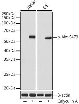 Phospho-Akt-S473 Rabbit mAb