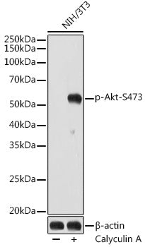 Phospho-Akt-S473 Rabbit mAb