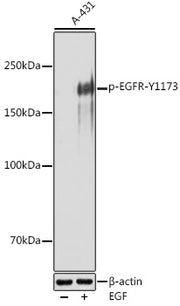 Phospho-EGFR-Y1173 Rabbit pAb