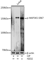 Phospho-MAP3K5-S967 Rabbit pAb