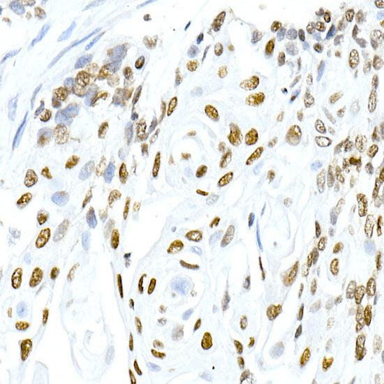 Phospho-Histone H3.3-S31 Rabbit mAb