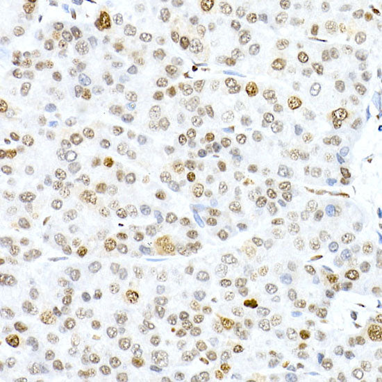 Phospho-Histone H3.3-S31 Rabbit mAb