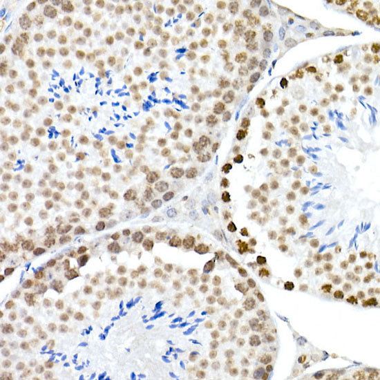 Phospho-Histone H3.3-S31 Rabbit mAb