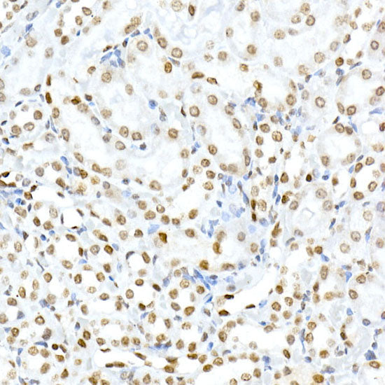 Phospho-Histone H3.3-S31 Rabbit mAb