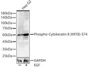 Phospho-Cytokeratin 8 (KRT8)-S74 Rabbit pAb