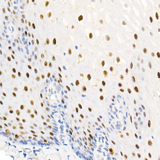 Phospho-Nucleolin-T76 Rabbit mAb