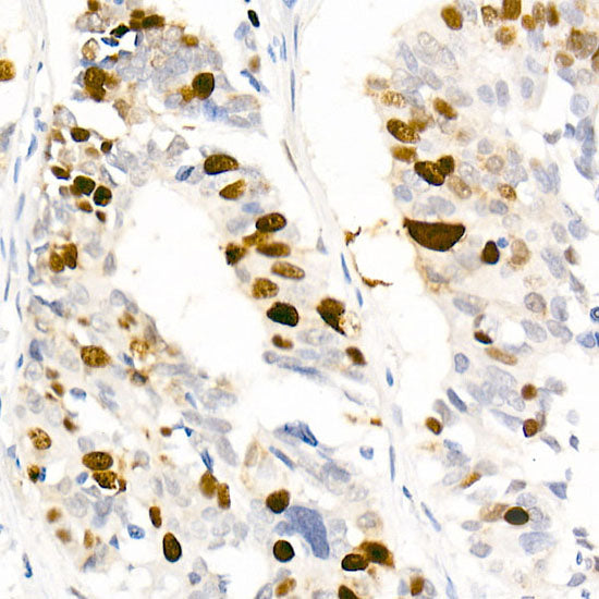 Phospho-Nucleolin-T76 Rabbit mAb
