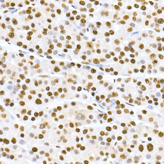 Phospho-MDM2-S166 Rabbit mAb