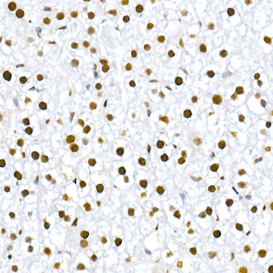 Phospho-MDM2-S166 Rabbit mAb