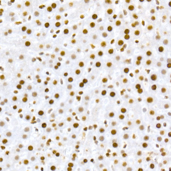 Phospho-MDM2-S166 Rabbit mAb