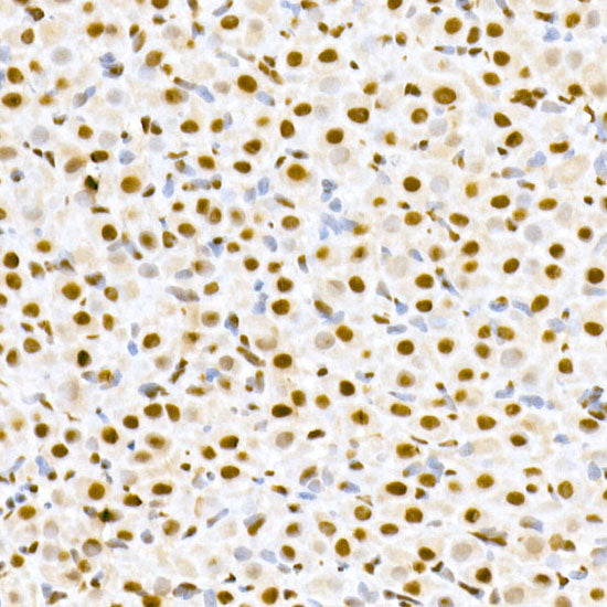 Phospho-MDM2-S166 Rabbit mAb