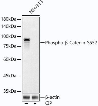Phospho-β-Catenin-S552 Rabbit mAb