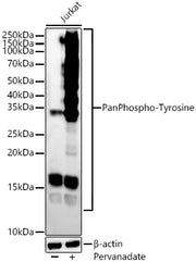 Pan Phospho-Tyrosine Rabbit mAb