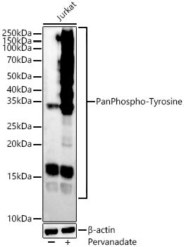 Pan Phospho-Tyrosine Rabbit mAb