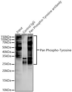 Pan Phospho-Tyrosine Rabbit mAb