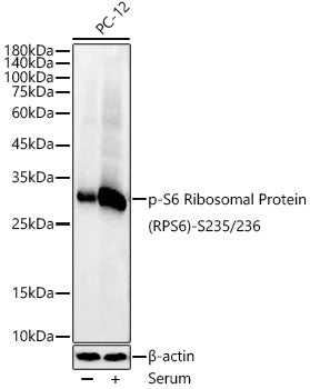Phospho-S6 Ribosomal Protein (RPS6)-S235/236 Rabbit mAb