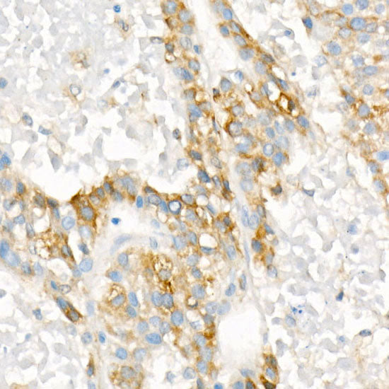 Phospho-S6 Ribosomal Protein (RPS6)-S235/236 Rabbit mAb