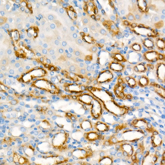 Phospho-S6 Ribosomal Protein (RPS6)-S235/236 Rabbit mAb