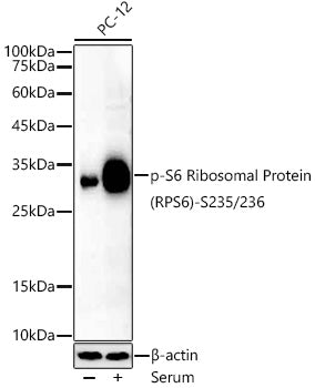Phospho-S6 Ribosomal Protein (RPS6)-S235/236 Rabbit mAb