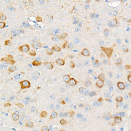 Phospho-S6 Ribosomal Protein (RPS6)-S235/236 Rabbit mAb
