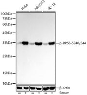 Phospho-S6 Ribosomal Protein (RPS6)-S240/244 Rabbit mAb