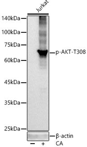 Phospho-Akt-T308 Rabbit mAb