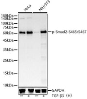 Phospho-Smad2-S465/S467 Rabbit mAb
