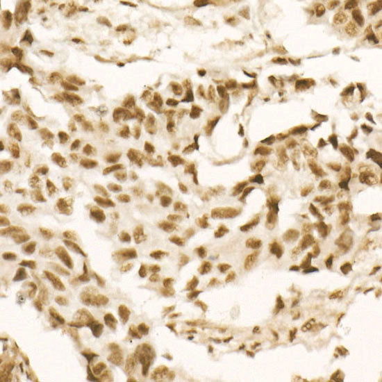 Phospho-PTEN-S380/T382/T383 Rabbit mAb