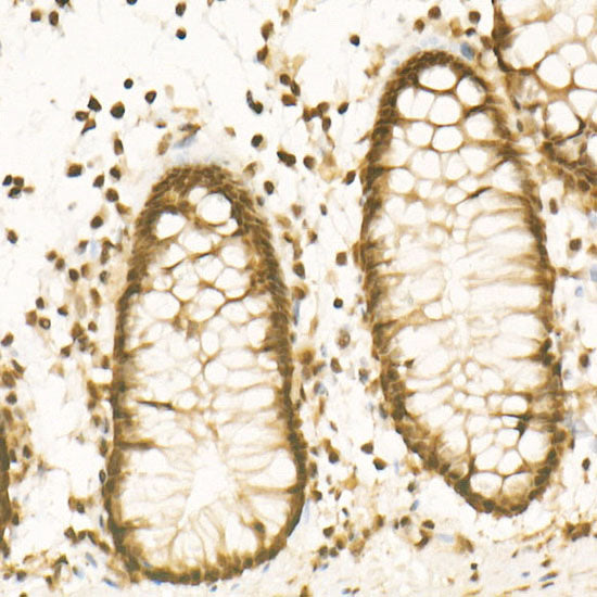 Phospho-PTEN-S380/T382/T383 Rabbit mAb