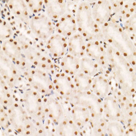 Phospho-PTEN-S380/T382/T383 Rabbit mAb