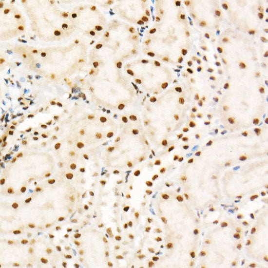 Phospho-PTEN-S380/T382/T383 Rabbit mAb