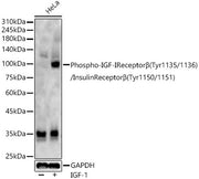 Phospho-IGF-IReceptorβ(Tyr1135/1136)/InsulinReceptorβ(Tyr1150/1151) Rabbit pAb