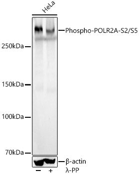 Phospho-Rpb1 CTD-S2/S5 Rabbit mAb