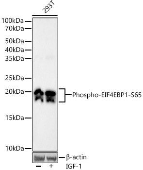 Phospho-eIF4EBP1-S65 Rabbit mAb