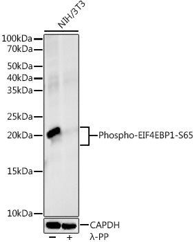 Phospho-eIF4EBP1-S65 Rabbit mAb