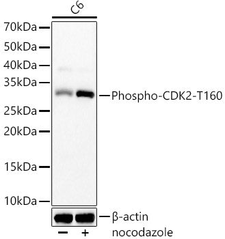 Phospho-CDK2-T160 Rabbit mAb