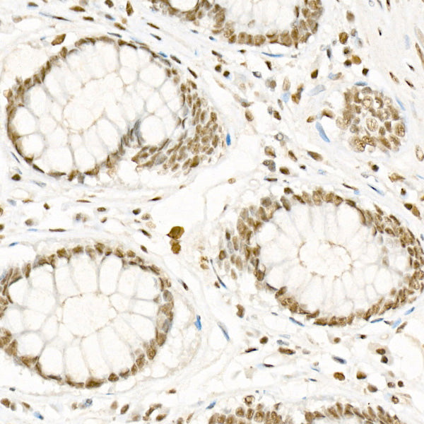 Phospho-CDK2-T160 Rabbit mAb