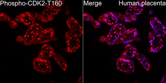 Phospho-CDK2-T160 Rabbit mAb